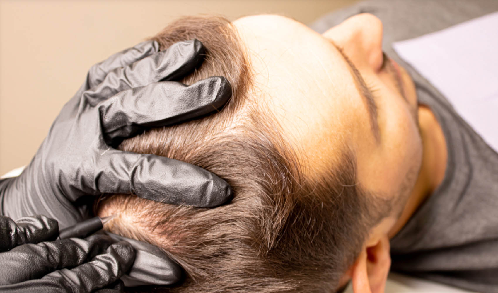 Web Optimized_0000_Hair Micropigmentation.png Hair Micropigmentation Permanent Makeup