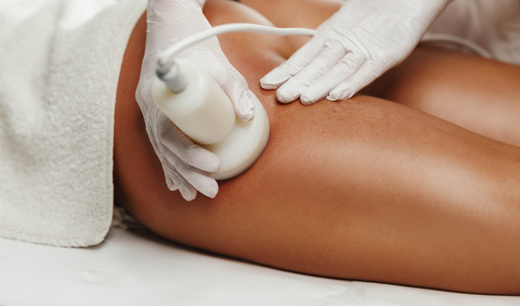 Web Optimized_0002_RF Skin Tightening.jpg RF Skin Tightening